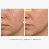 Honey Glow 65% Propolis Serum with Hyaluronic Acid, Kojic Acid & Niacinamide, Hydrating Facial Serum 33ml, 1.11 fl.oz.