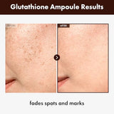 Glutathione Serum with 20,000ppm Glutathione, Niacinamide and hyaluronic acid, Dark Spot,Korean Skincare, 30ml, 1.01 fl. oz.