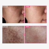 Arbutin 7% + Tranexamic Acid 4% Cream, 70,000ppm Arbutin, 40,000ppm TXA, Niacinamide, Glutathione, Dark Spots, Freckles, Korean Skin Care, 50ml, 1.69 fl.oz.