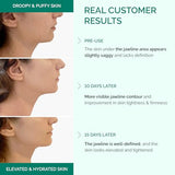 Face Mask V-Line 5 PCS with Hyaluronic Acid Chin Mask Jawline Shaper