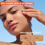 Garnier SkinActive Vitamin C Reduces Dark Spots & Evens Skin Tone, Serum 30ml