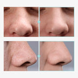 Pore Tightening Serum, Instantly Reduces Pores, Smooths Skin & Strengthens Barrier, Formulated With Niacinamide & Allantoin, 30ml, 1.01 fl. oz.