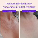 Chest Wrinkle Pads - Reusable Overnight - Neck & Décolleté (1-mo Supply)