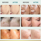 Corrector Cream for Face and Body, Natural Ingredient 1 Fl Oz