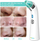 Blackhead Remover Vacuum Pore Cleaner