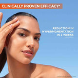 Garnier SkinActive Vitamin C Reduces Dark Spots & Evens Skin Tone, Serum 30ml
